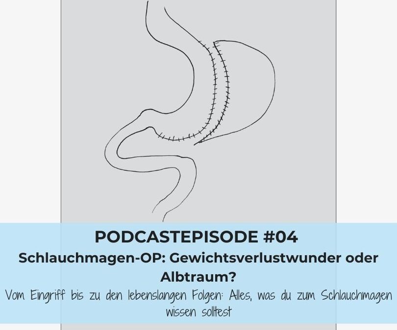 #04: Schlauchmagen-OP: Gewichtsverlustwunder oder Albtraum?