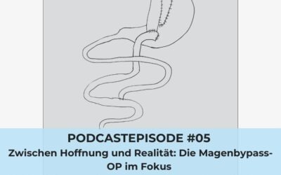 #05: Zwischen Hoffnung und Realität: Die Magenbypass-OP im Fokus